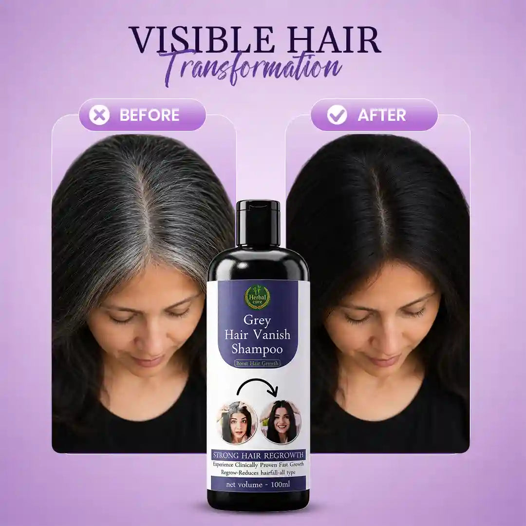 Grey Hair Vanish Shampoo – Grey Hair Care & Stronger Hair ⭐